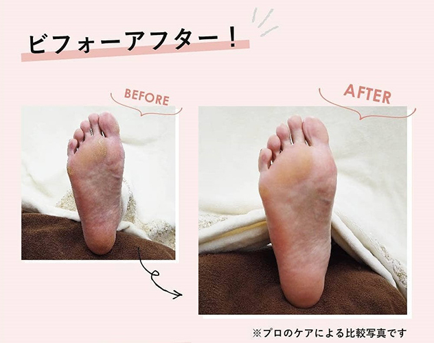 ビフォーアフター