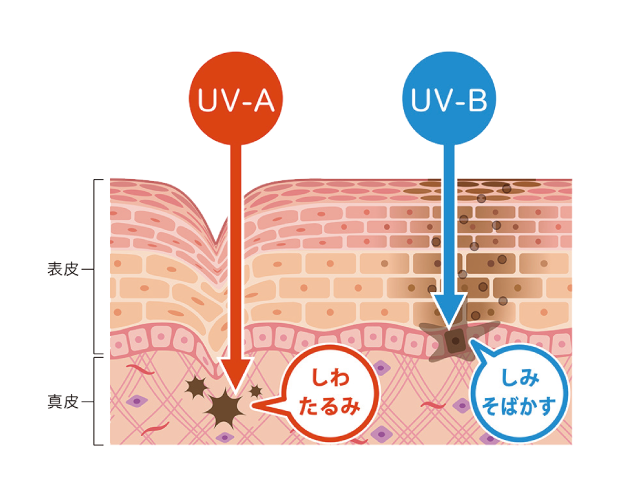 しわやたるみの原因